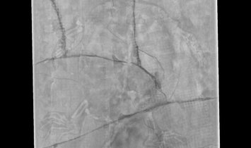 Fossil Turtle Manchurochelys from the Cretaceous with X-ray image